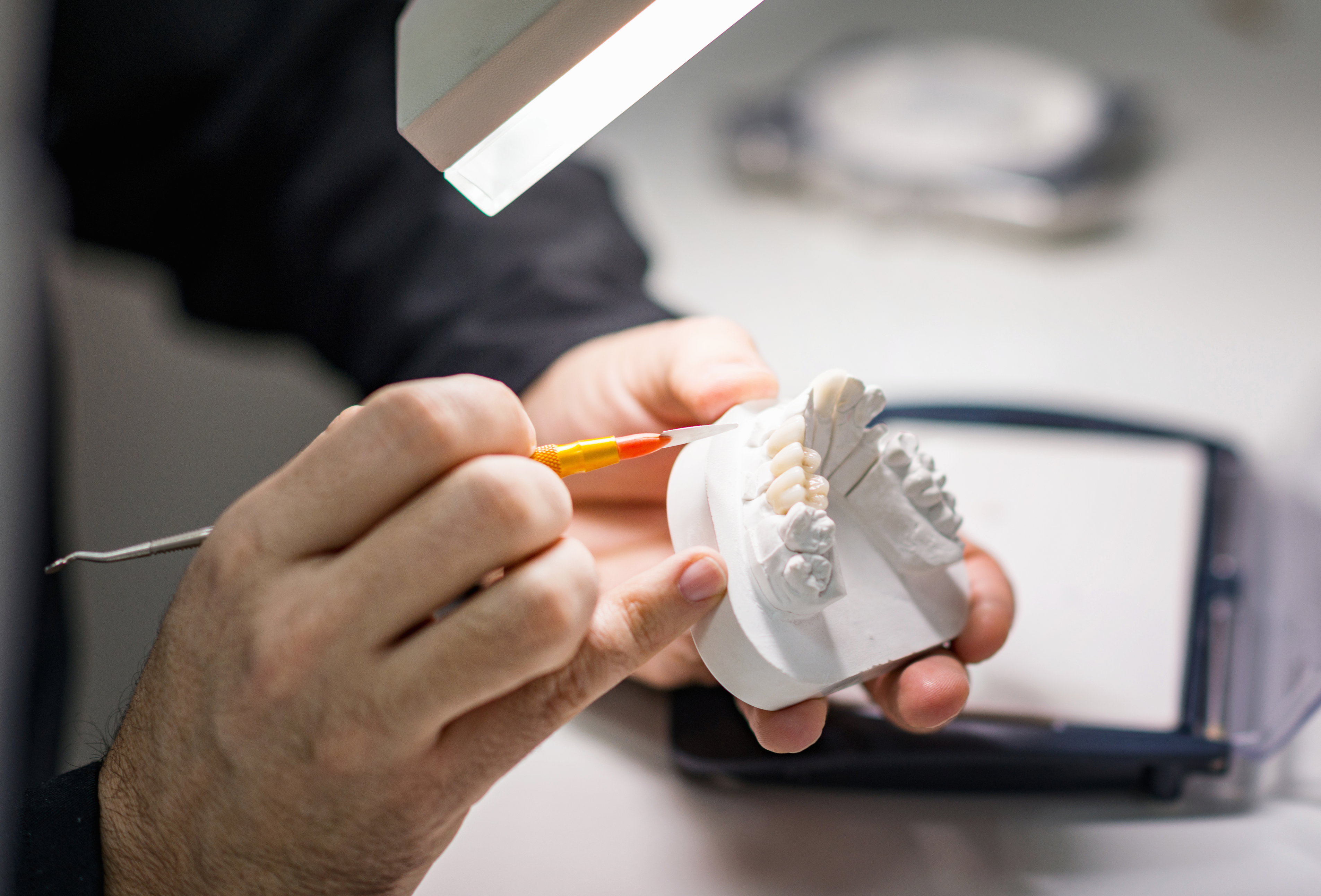Dental prosthetic laboratory work